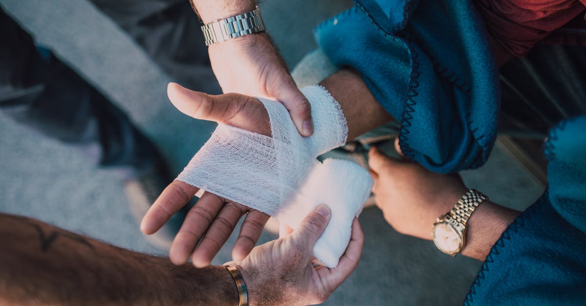 close up of two people bandaging an injured hand outdoors focusing on first aid care